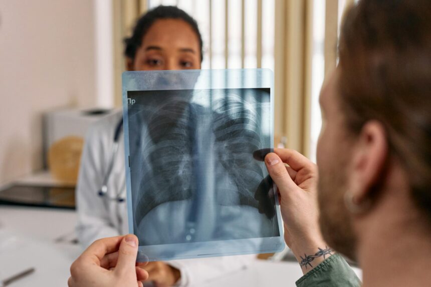 Medical illustration showing geographic map with lung transplant access indicators across US regions