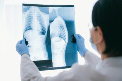 NHS mobile CT scanning truck parked in supermarket car park providing lung cancer screening