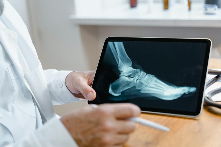 Medical illustration showing osteomyelitis bone infection diagnosis and treatment advances