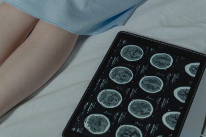 Microscopic brain tumor tissue sample being analyzed by AI diagnostic system