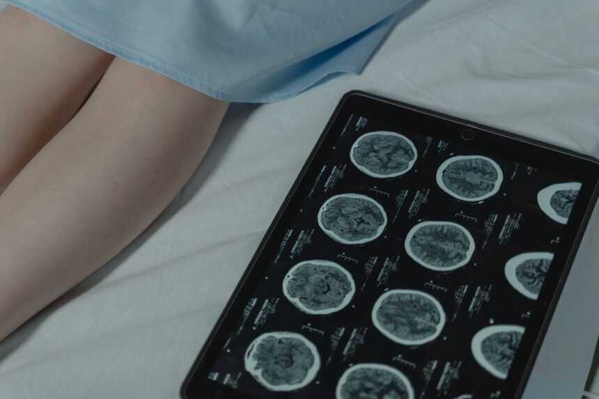 Microscopic brain tumor tissue sample being analyzed by AI diagnostic system