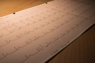 Artificial intelligence diagnostic imaging analysis of the heart showing advanced cardiac pathology identified for transplantation