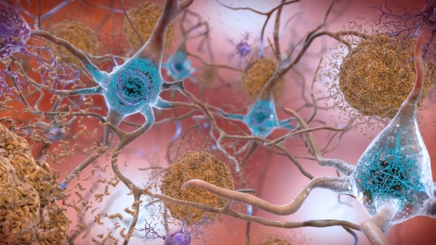 Diagram showing amyloid beta disrupting tau protein function in neurons