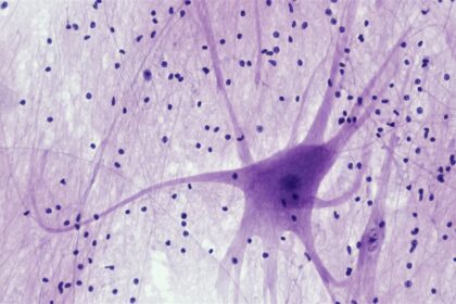 Diagram showing astrocytes, microglia, neurons, and oligodendrocytes communicating in the brain with inflammatory and protective signaling pathways