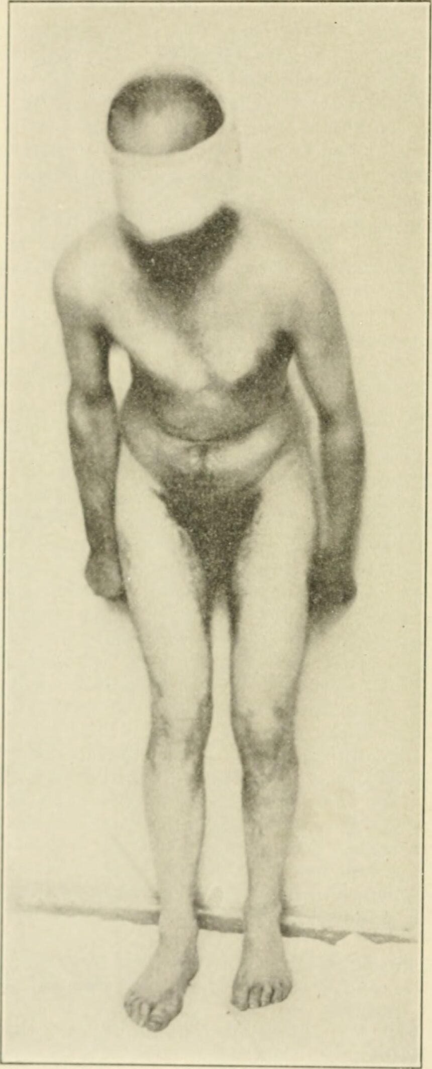 Anatomical illustration of brain-spine circuits controlling upright posture and gait