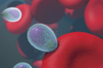 Medical illustration showing CAR T cells targeting antibodies in kidney transplant patient