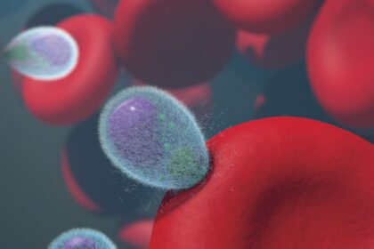 Medical illustration showing CAR T cells targeting antibodies in kidney transplant patient