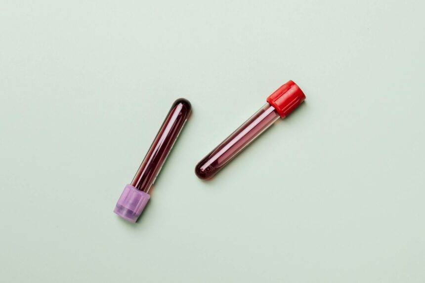 Medical laboratory blood test tubes representing new endometriosis diagnostic technology