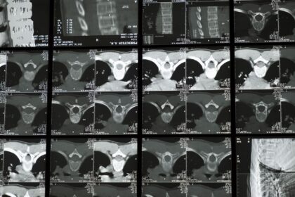 Medical imaging workstation showing before and after processing times with FireANTs algorithm
