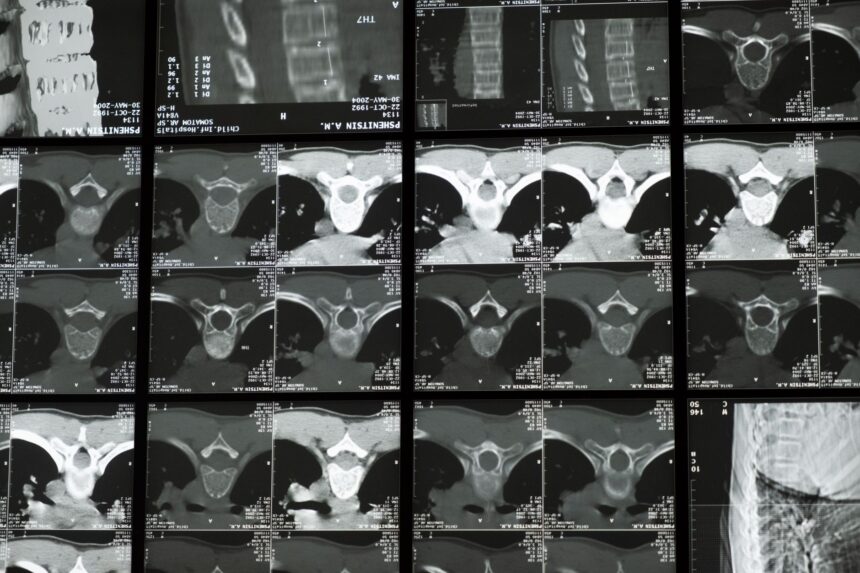 Medical imaging workstation showing before and after processing times with FireANTs algorithm