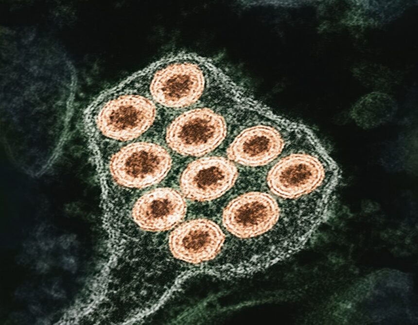 Diagram illustrating influenza transmission mechanisms: viral shedding, aerosol generation, and contact duration