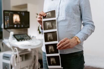 Virtual reality headset displaying 3D ultrasound imaging visualization technology