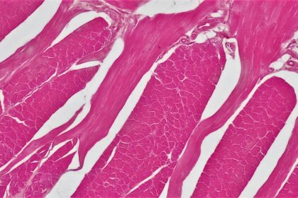 Illustration of GLUT4 glucose transporter activation in muscle cells during contraction