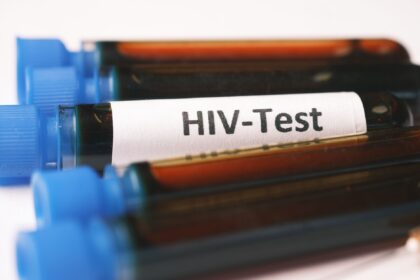 NHS emergency department HIV testing programme data showing 1,953 newly diagnosed cases across 88 English regions