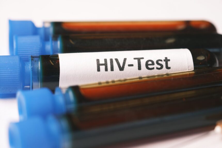 NHS emergency department HIV testing programme data showing 1,953 newly diagnosed cases across 88 English regions
