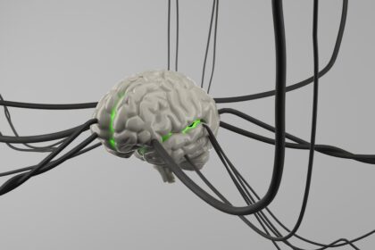 Medical illustration of spinal cord stimulation device for stroke rehabilitation therapy