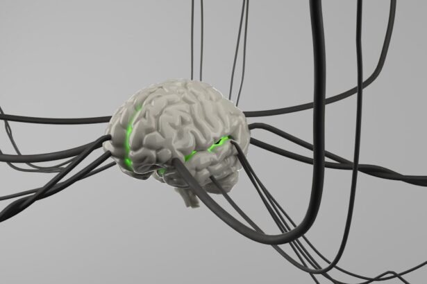 Medical illustration of spinal cord stimulation device for stroke rehabilitation therapy