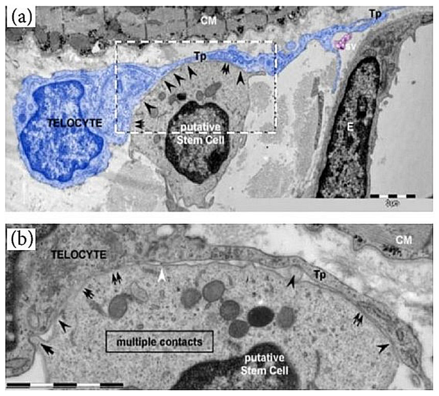Live-cell microscopy showing a stem cell differentiating into a cardiomyocyte with organized sarcomeres and rhythmic contractions