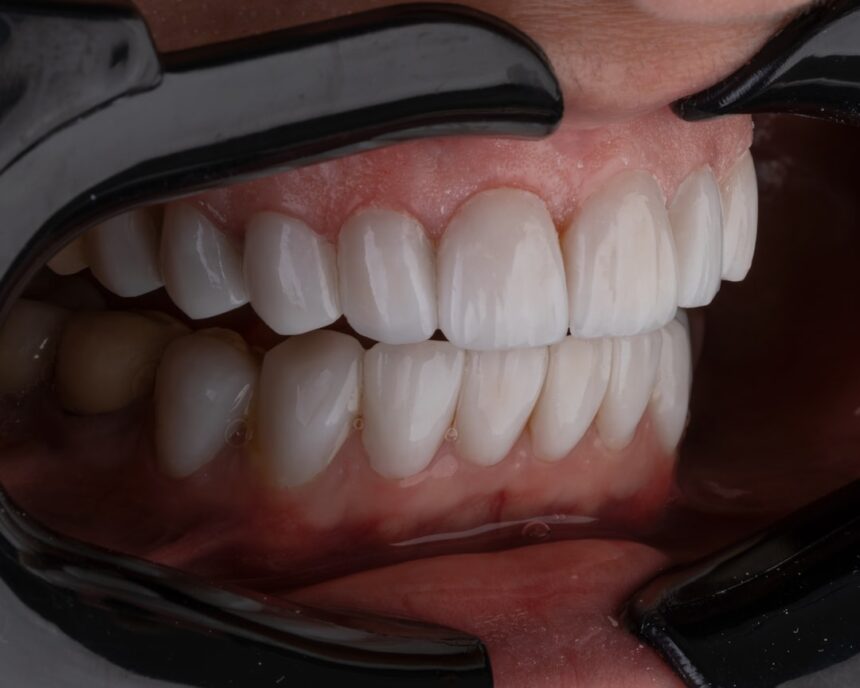 Dental anatomy diagram showing primary and permanent teeth development across the human lifespan