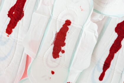 Medical professionals in operating room demonstrating surgical safety protocols with tranexamic acid