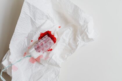 Medical illustration showing surgical bleeding reduction with tranexamic acid treatment
