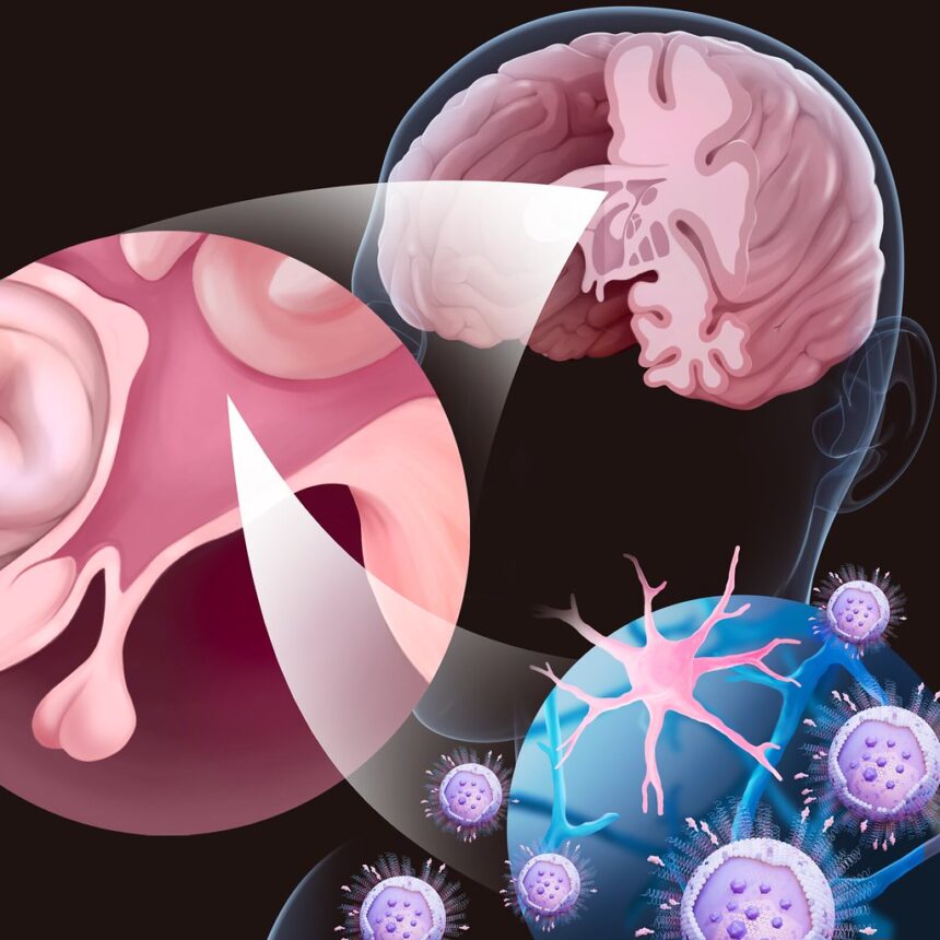Scientific illustration of brain inflammation pathways in Alzheimer's disease research