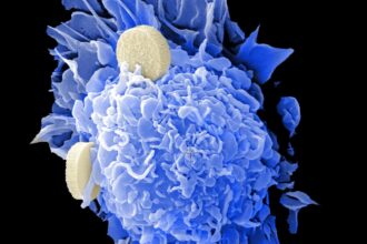 Prostate cancer risk stratification by histological grade and genetic markers