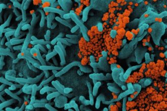 Microscopic view of colorectal cancer cells with bacterial treatment pathway illustration