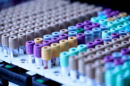Microscopic visualization of circular RNA molecules in blood plasma for Alzheimer's disease biomarker detection