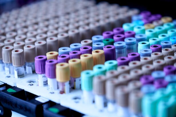 Microscopic visualization of circular RNA molecules in blood plasma for Alzheimer's disease biomarker detection