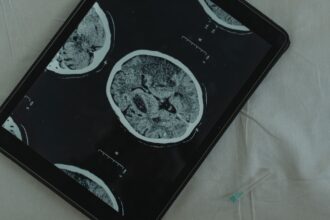 Infographic showing menopause timing correlation with brain aging clocks and dementia risk markers