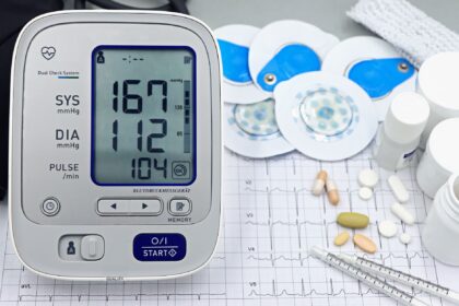 An electrocardiogram (EKG) trace displayed on medical monitor, representing pre-participation screening for young athletes