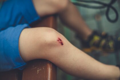 Hospital discharge data comparing insurance status among gunshot wound patients
