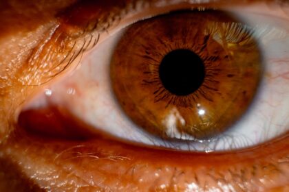 Illustration of genetic analysis for glaucoma risk assessment and early eye disease detection