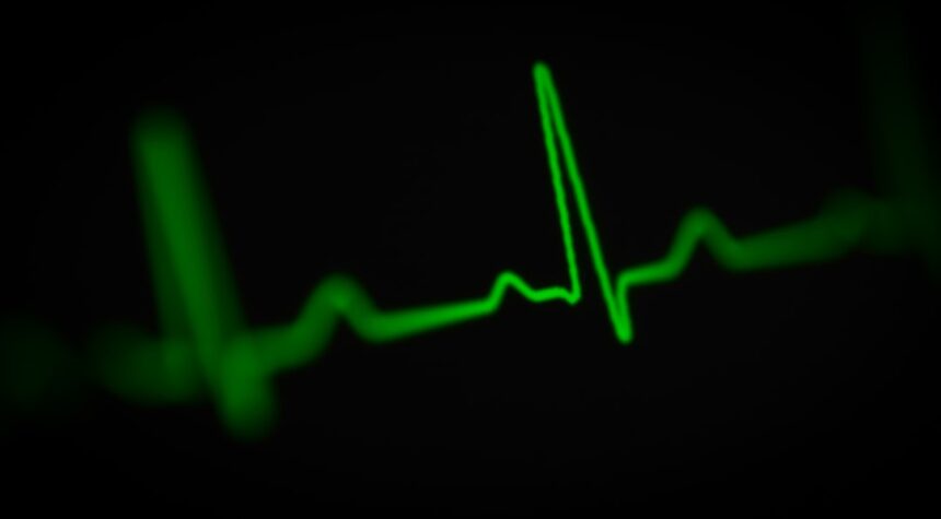 Diagram showing heart palpitation symptoms and clinical assessment pathway