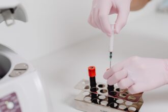 Mass spectrometry metabolomic analysis identifying histidine as immunotherapy survival predictor