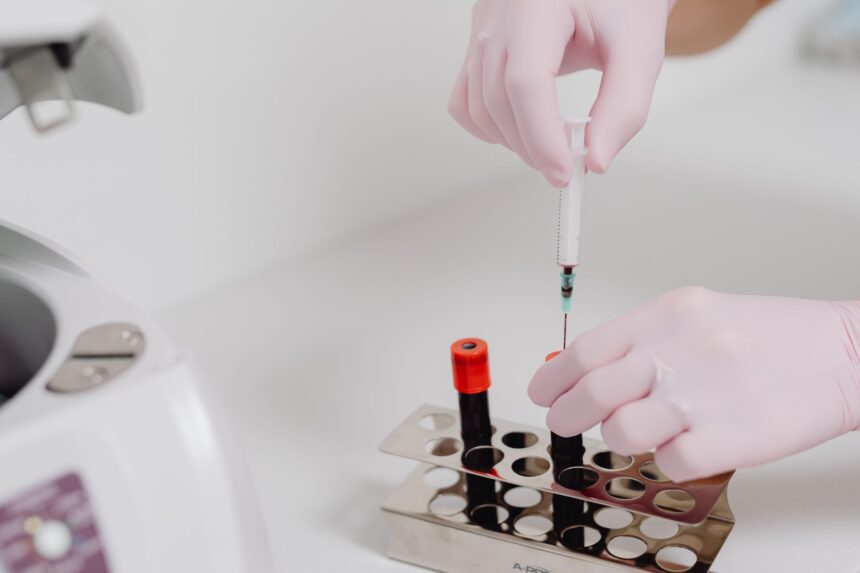 Mass spectrometry metabolomic analysis identifying histidine as immunotherapy survival predictor