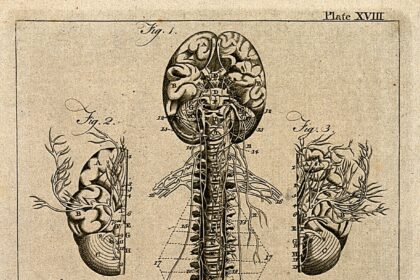 Anatomical illustration of spine and spinal nerves with dermatome segmentation showing cervical, thoracic, lumbar, and sacral regions