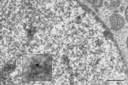 Microscopic representation of multiple myeloma cells and T-cell engagement via bispecific antibody.