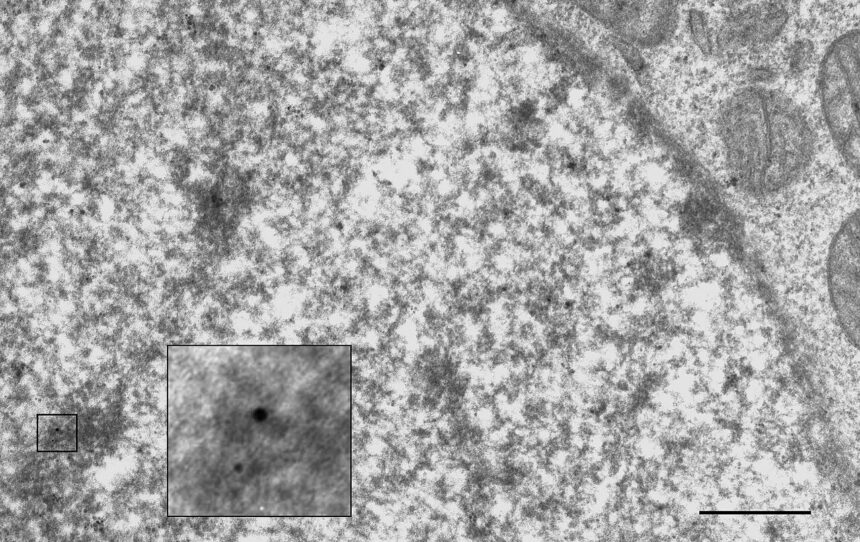 Microscopic representation of multiple myeloma cells and T-cell engagement via bispecific antibody.