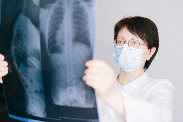 Medical illustration of three distinct severe pneumonia subtypes and their clinical trajectories in intensive care