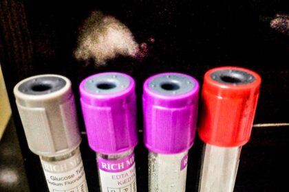 Vitamin K counteracts warfarin anticoagulation