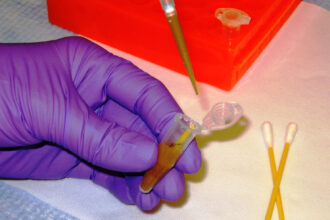 Analytical laboratory testing a dietary supplement sample