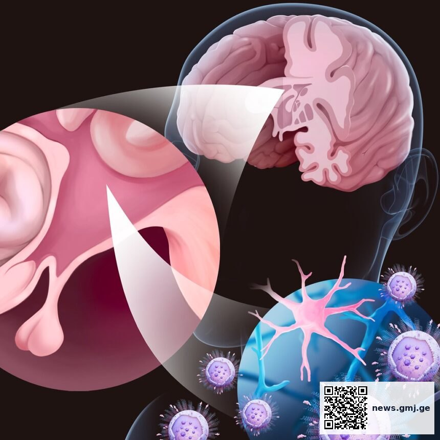 Scientific illustration of brain inflammation pathways in Alzheimer's disease research