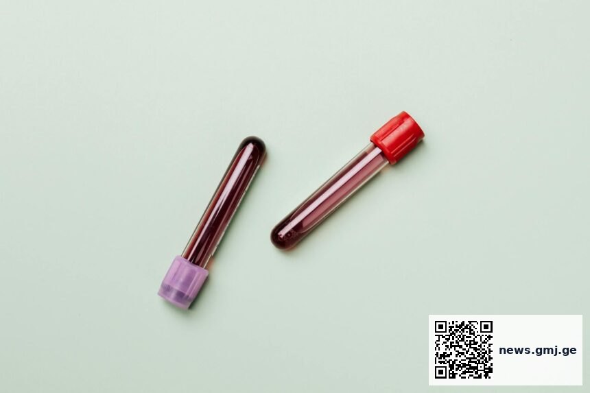 Medical laboratory blood test tubes representing new endometriosis diagnostic technology