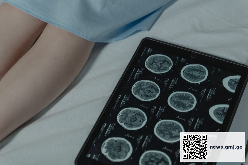 Microscopic brain tumor tissue sample being analyzed by AI diagnostic system