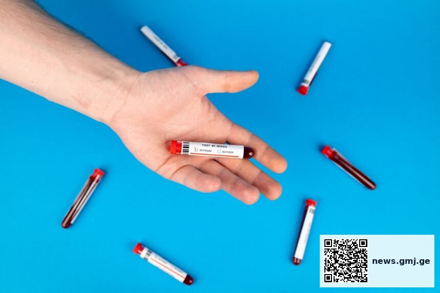Medical researcher examining blood samples for biological age testing in laboratory setting