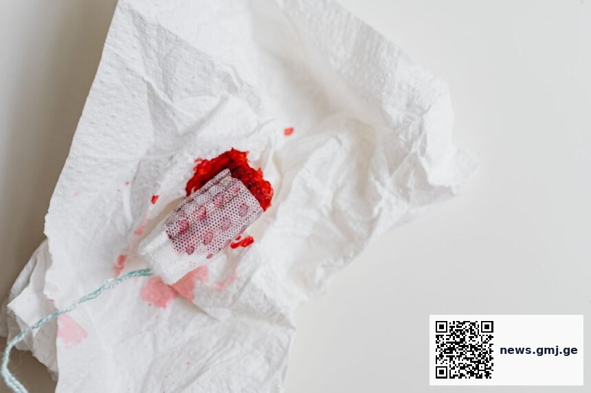 Medical illustration showing surgical bleeding reduction with tranexamic acid treatment