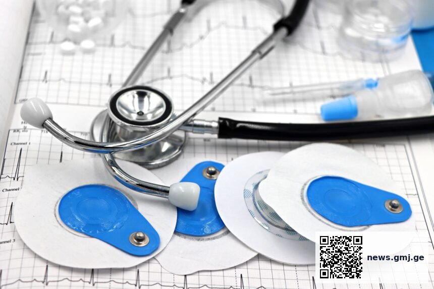 Medical illustration of implantable cardioverter defibrillator placement in chest