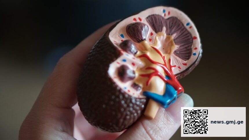 Illustration of kidney transplant with donor bone marrow and regulatory T cell infusion protocol